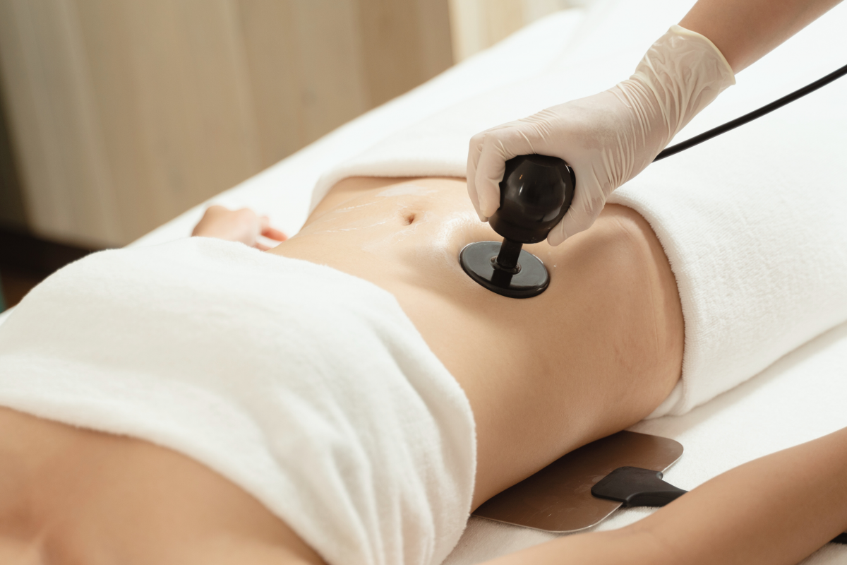 GIẢM MỠ & ĐỊNH HÌNH CƠ THỂ